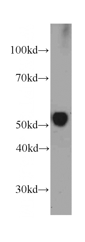 human testis tissue were subjected to SDS PAGE followed by western blot with Catalog No:107542(VDBP,GC Antibody) at dilution of 1:4000