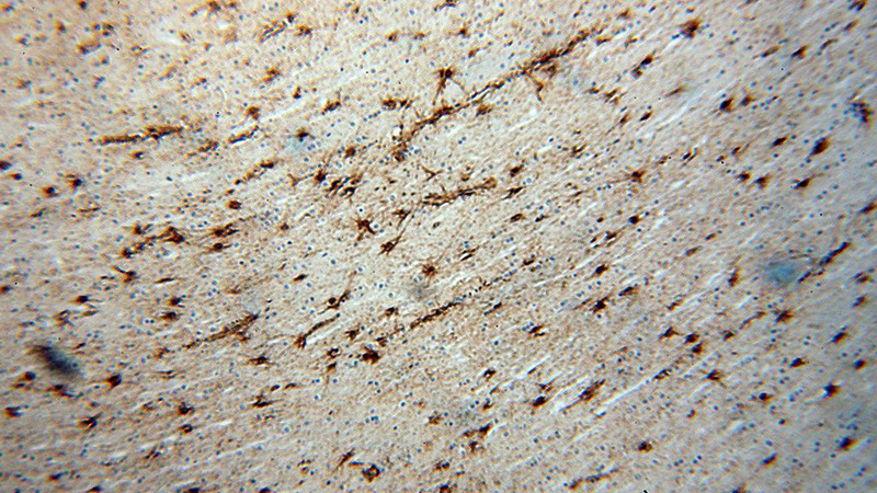 Immunohistochemical of paraffin-embedded human brain using Catalog No:110629(FGF1 antibody) at dilution of 1:50 (under 10x lens)