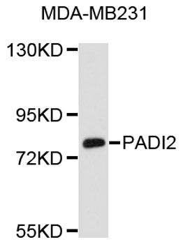 Western blot - PADI2 Polyclonal Antibody 