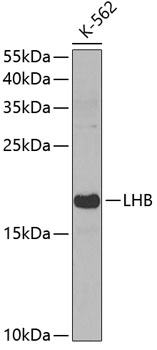 Western blot - LHB Polyclonal Antibody 