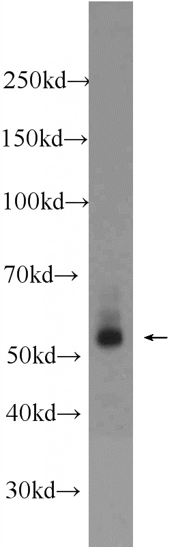 HeLa cells were subjected to SDS PAGE followed by western blot with Catalog No:114755(RNF25 Antibody) at dilution of 1:3000
