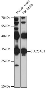 Western blot - SLC25A31 Polyclonal Antibody 