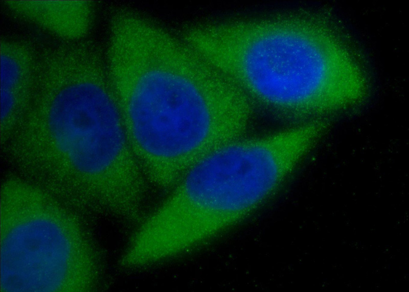 Immunofluorescent analysis of HeLa cells using Catalog No:112275(LAMP1 Antibody) at dilution of 1:50 and Alexa Fluor 488-congugated AffiniPure Goat Anti-Rabbit IgG(H+L)