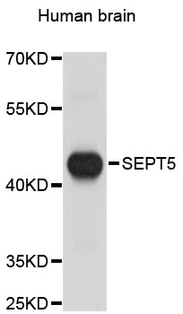 Western blot - SEPT5 Polyclonal Antibody 