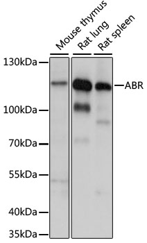 Western blot - ABR Polyclonal Antibody 