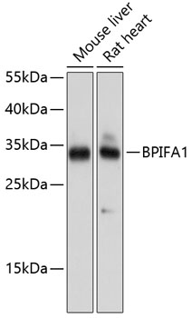 Western blot - BPIFA1 Polyclonal Antibody 