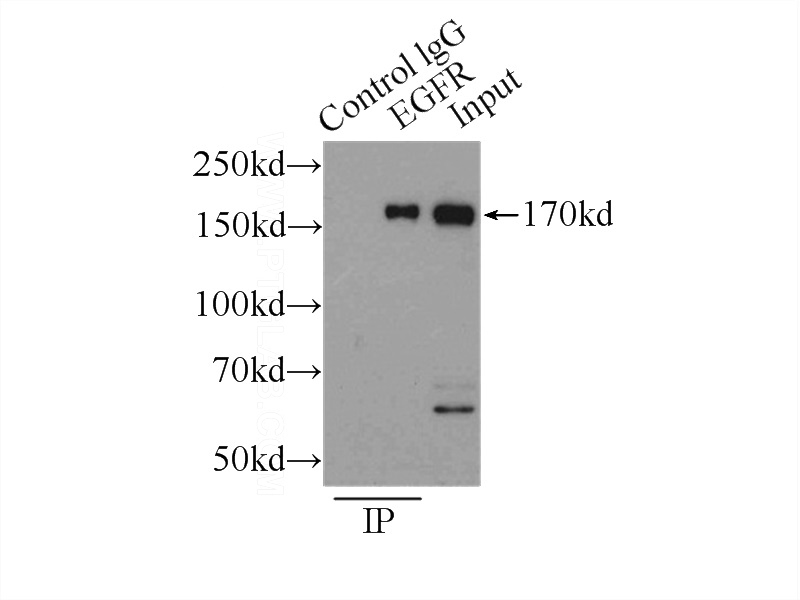 IP Result of anti-EGFR-Specific (IP:Catalog No:110218, 3ug; Detection:Catalog No:110218 1:500) with MCF-7 cells lysate 2500ug.