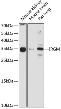 Western blot - IRGM Polyclonal Antibody 