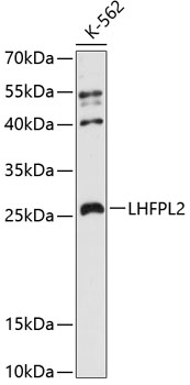 Western blot - LHFPL2 Polyclonal Antibody 