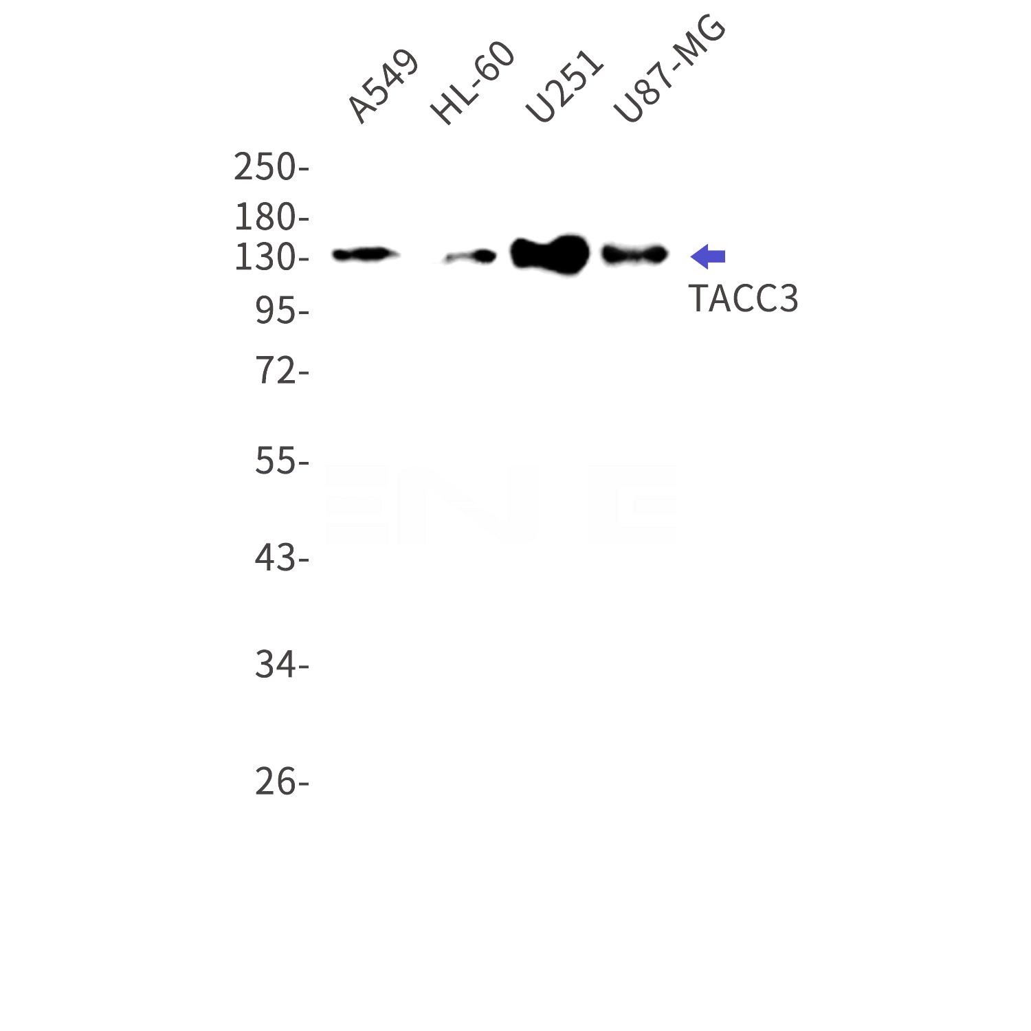Western blot detection of TACC3 in A549,HL-60,U251,U87-MG cell lysates using TACC3 Rabbit mAb(1:1000 diluted).Predicted band size:90kDa.Observed band size:140kDa.