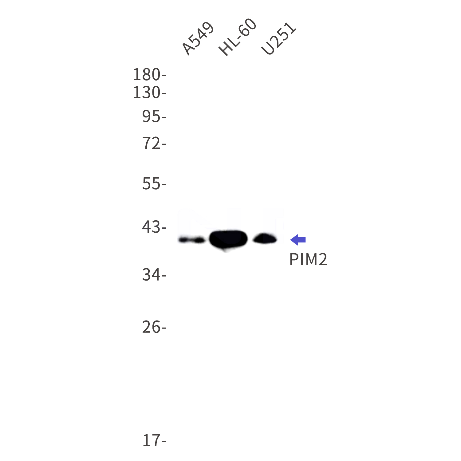 Western blot detection of PIM2 in A549,HL-60,U251 cell lysates using PIM2 Rabbit mAb(1:1000 diluted).Predicted band size:34kDa.Observed band size:40,38,34kDa.