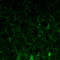 Immunofluorescence analysis of paraffin-embedded lobe of brain tissues using GFAP mouse mAb (green).