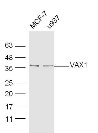 Fig4: Sample:; MCF-7 Cell (Human) Lysate at 40 ug; U937 Cell (Human) Lysate at 40 ug; Primary: Anti-VAX1 at 1/300 dilution; Secondary: IRDye800CW Goat Anti-Rabbit IgG at 1/20000 dilution; Predicted band size: 35 kD; Observed band size: 36 kD