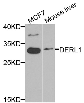 Western blot - DERL1 Polyclonal Antibody 