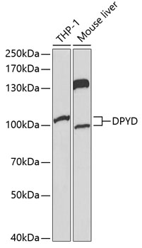 Western blot - DPYD Polyclonal Antibody 