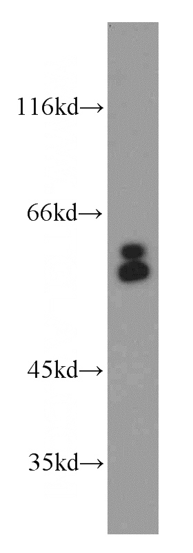 HepG2 cells were subjected to SDS PAGE followed by western blot with Catalog No:108252(ARFGAP3 antibody) at dilution of 1:2000