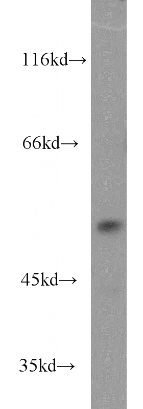 Jurkat cells were subjected to SDS PAGE followed by western blot with Catalog No:110111(DUS1L antibody) at dilution of 1:1500