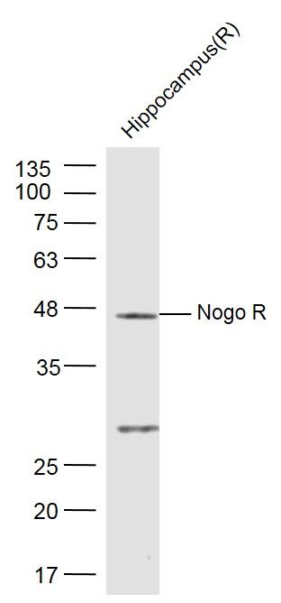 Fig4: Sample:; Hippocampus (Rat) Lysate at 40 ug; Primary: Anti- Nogo R at 1/300 dilution; Secondary: IRDye800CW Goat Anti-Rabbit IgG at 1/20000 dilution; Predicted band size: 48 kD; Observed band size: 48 kD