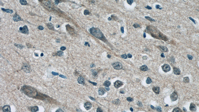 Immunohistochemistry of paraffin-embedded human brain tissue slide using Catalog No:112534(MFSD8 Antibody) at dilution of 1:50 (under 40x lens)