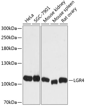 Western blot - LGR4 Polyclonal Antibody 