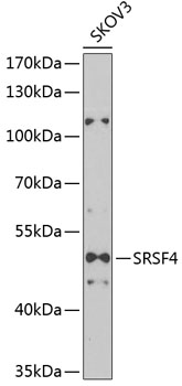 Western blot - SRSF4 Polyclonal Antibody 