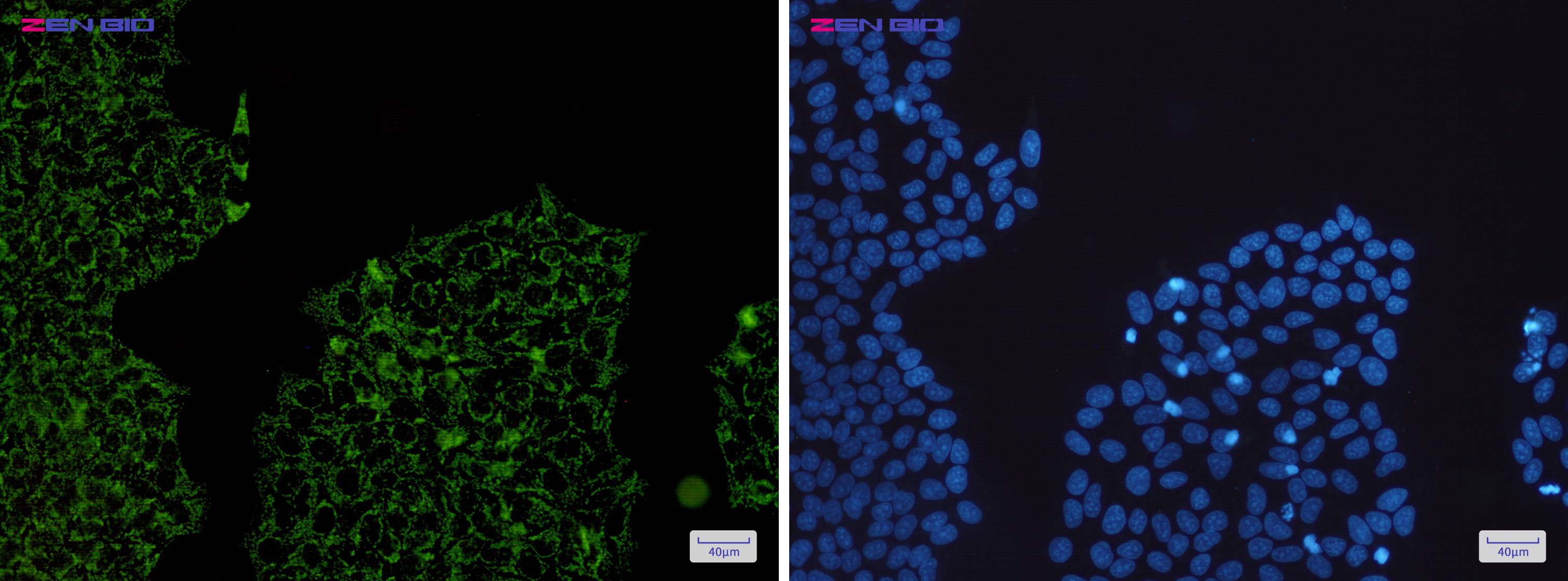 Immunocytochemistry of HADHA(green) in Hela cells using HADHA Rabbit mAb at dilution 1/200, and DAPI(blue)