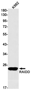 Western blot detection of RAIDD in K562 cell lysates using RAIDD Rabbit mAb(1:1000 diluted).Predicted band size:23kDa.Observed band size:23kDa.