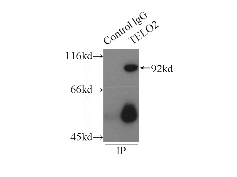 IP Result of anti-TELO2 (IP:Catalog No:107619, 4ug; Detection:Catalog No:107619 1:500) with HepG2 cells lysate 2900ug.
