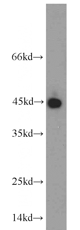 mouse heart tissue were subjected to SDS PAGE followed by western blot with Catalog No:113603(PAWR antibody) at dilution of 1:400