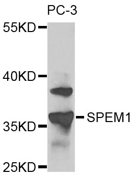 Western blot - SPEM1 Polyclonal Antibody 