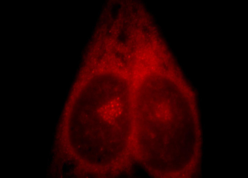 Immunofluorescent analysis of Hela cells, using TULP1 antibody Catalog No:116491 at 1:25 dilution and Rhodamine-labeled goat anti-rabbit IgG (red).
