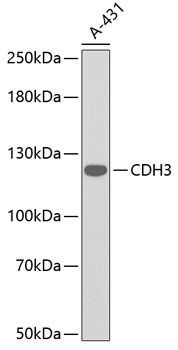 Western blot - CDH3 Polyclonal Antibody 