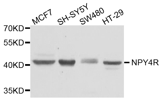 Western blot - NPY4R Polyclonal Antibody 