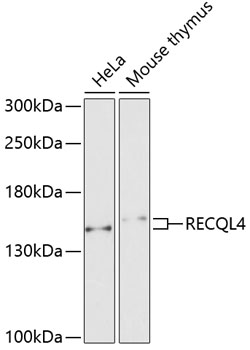 Western blot - RECQL4 Polyclonal Antibody 