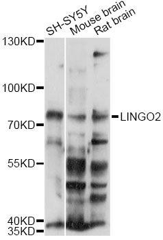 Western blot - LINGO2 Polyclonal Antibody 