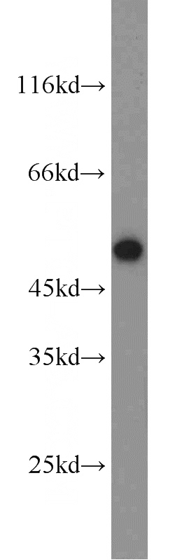 L02 cells were subjected to SDS PAGE followed by western blot with Catalog No:107794(ADIPOR2 antibody) at dilution of 1:500