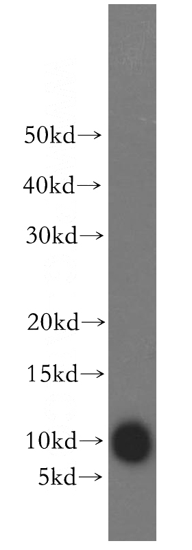 SH-SY5Y cells were subjected to SDS PAGE followed by western blot with Catalog No:114840(RPS27L antibody) at dilution of 1:300