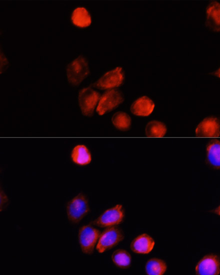 Immunofluorescence - TYR Polyclonal Antibody 