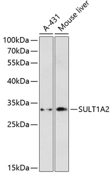 Western blot - SULT1A2 Polyclonal Antibody 