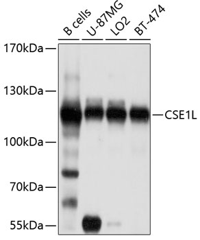 Western blot - CSE1L Polyclonal Antibody 