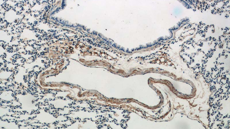 Immunohistochemical of paraffin-embedded mouse lung using Catalog No:113442(Bglap1 antibody) at dilution of 1:50 (under 10x lens)