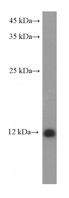 human lung tissue were subjected to SDS PAGE followed by western blot with Catalog No:107517(S100A10 Antibody) at dilution of 1:2000