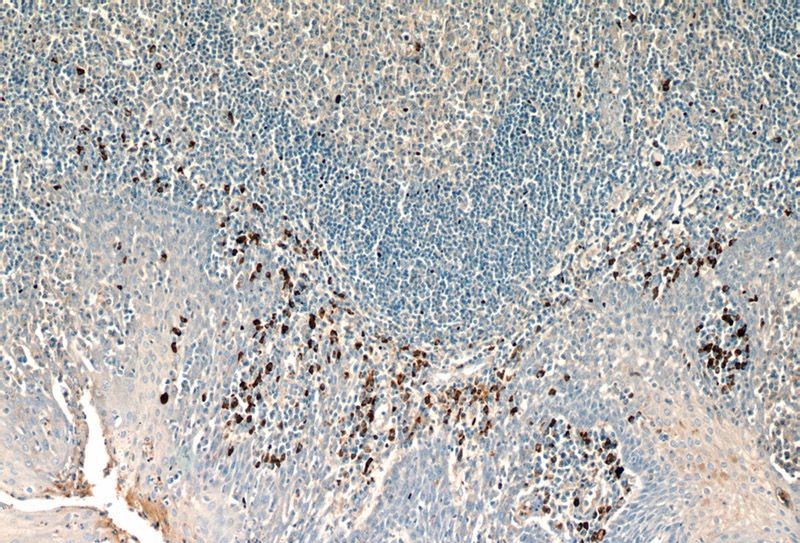 Immunohistochemical of paraffin-embedded human tonsil using Catalog No:107270(IGHA1 antibody) at dilution of 1:50 (under 10x lens)