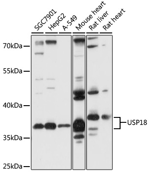 Western blot - USP18 Polyclonal Antibody 