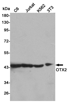 Western blot detection of OTX2 in C6,Jurkat,K562 and 3T3 cell lysates using OTX2 mouse mAb (1:500 diluted).Predicted band size:32KDa.Observed band size:40KDa.