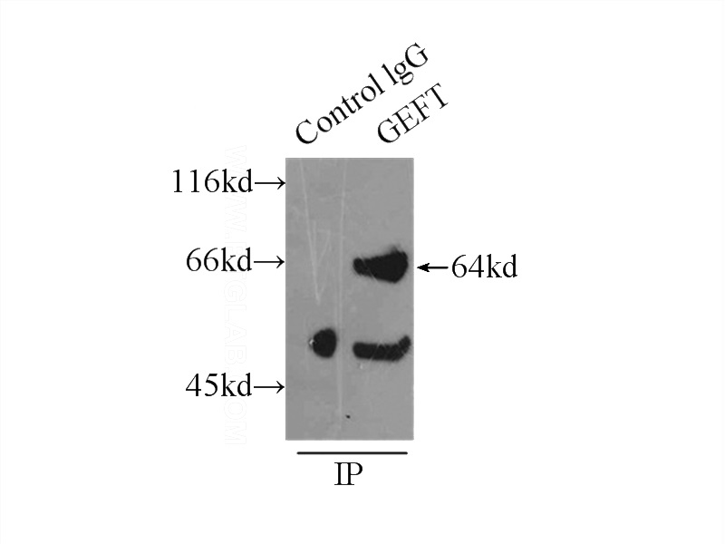 IP Result of anti-GEFT-Specific (IP:Catalog No:110935, 4ug; Detection:Catalog No:110935 1:1500) with mouse brain tissue lysate 8000ug.