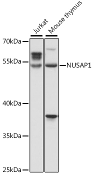 Western blot - NUSAP1 Polyclonal Antibody 