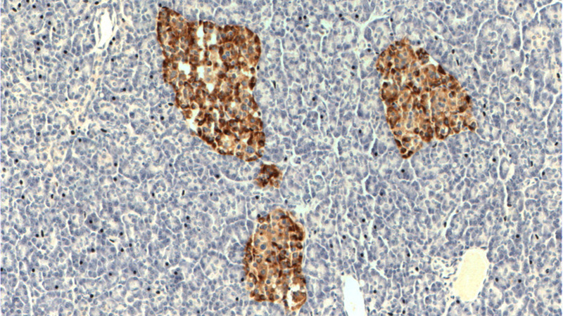 Immunohistochemistry of paraffin-embedded human pancreas tissue slide using Catalog No:109287(CHGA Antibody) at dilution of 1:400 (under 10x lens).