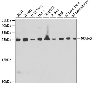 Western blot - PSMA2 Polyclonal Antibody 