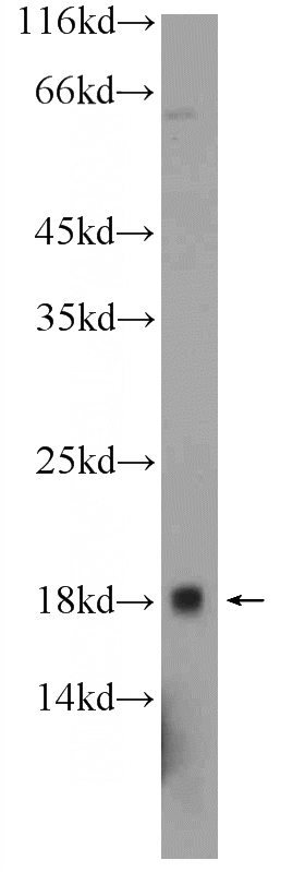 PC-3 cells were subjected to SDS PAGE followed by western blot with Catalog No:108634(C10orf67 Antibody) at dilution of 1:300